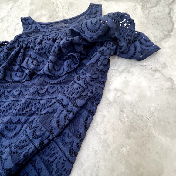 Lilly Pulitzer High Tide Navy Scalloped Stripe Lace Lyra Top Size XS XSmall - Picture 5 of 6